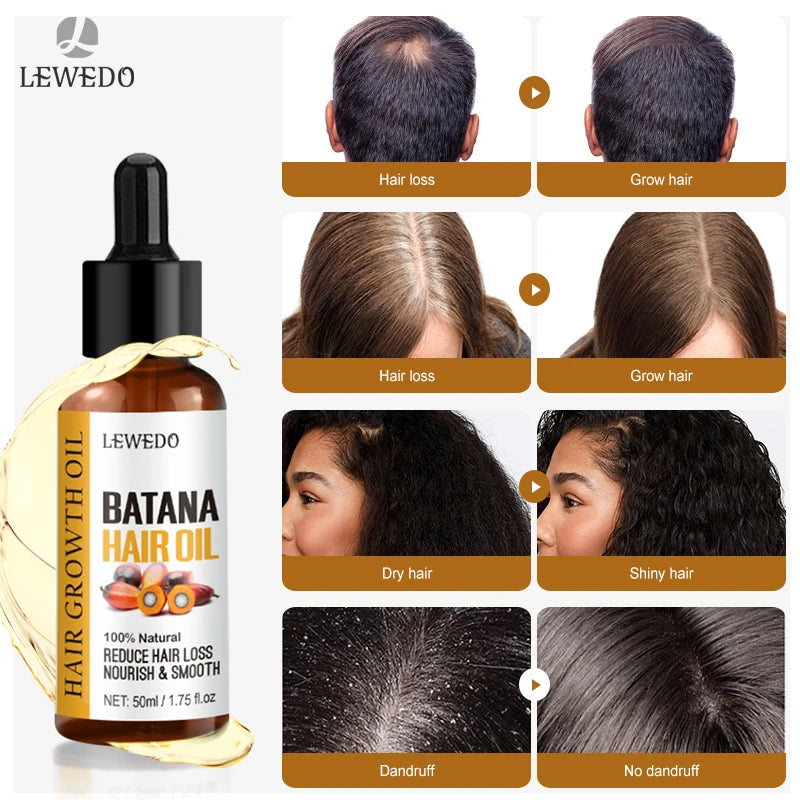 Lewedo Hair Growth Batana Oil Serum