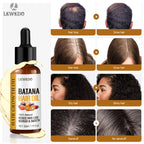 Lewedo Hair Growth Batana Oil Serum