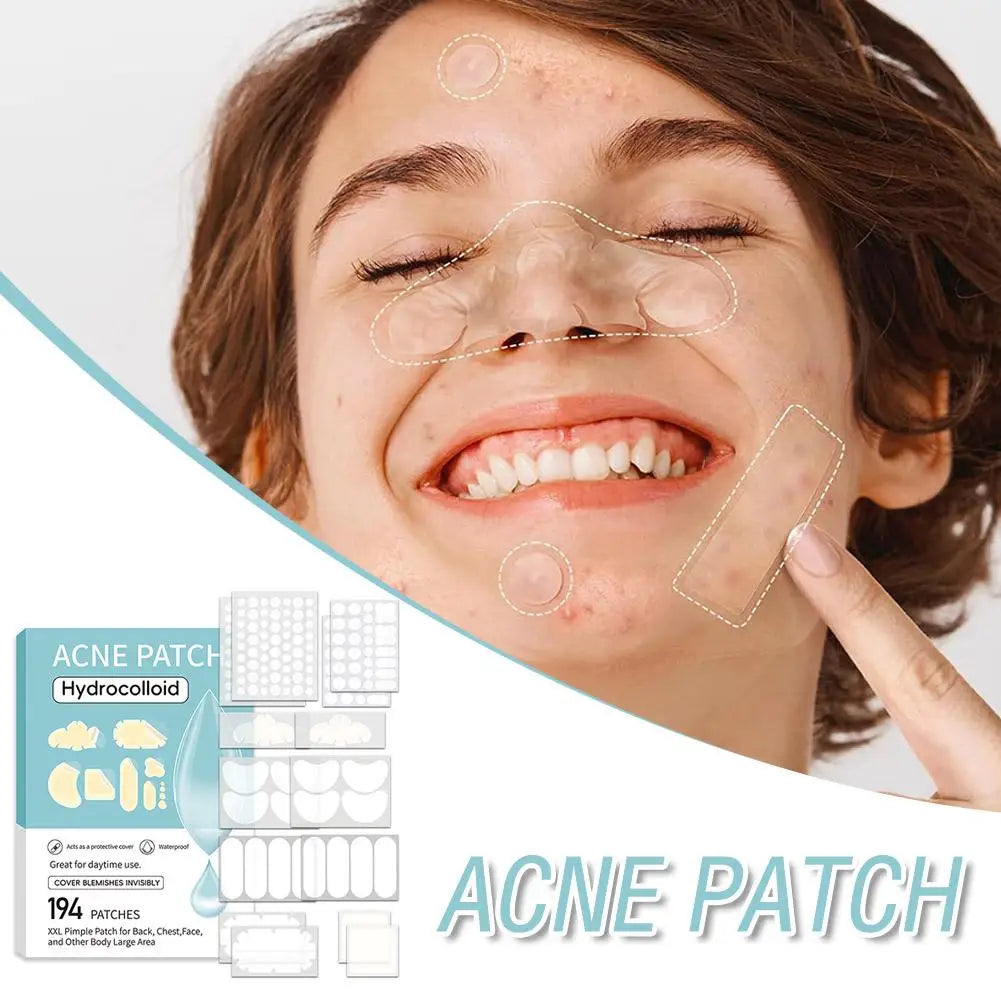 Large capacity Pimple Patches for Acne & Blemishes