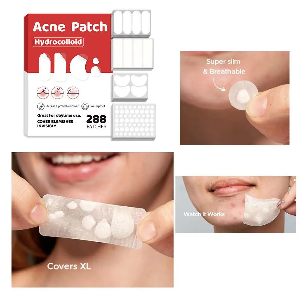 Large capacity Pimple Patches for Acne & Blemishes