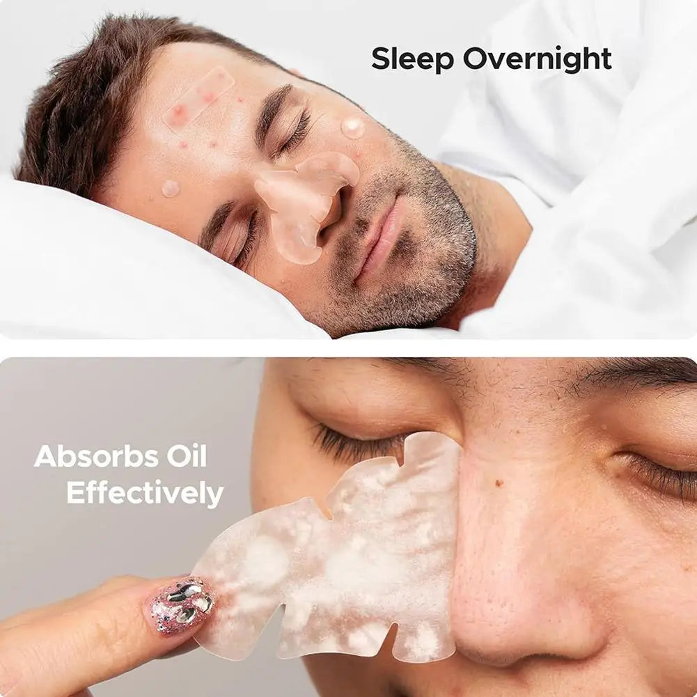 Large capacity Pimple Patches for Acne & Blemishes