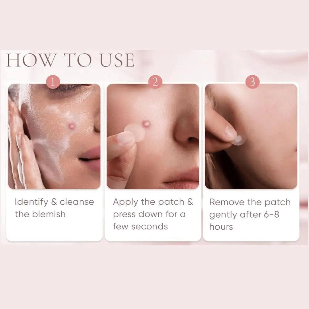 Large capacity Pimple Patches for Acne & Blemishes