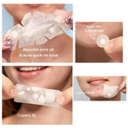 Large capacity Pimple Patches for Acne & Blemishes