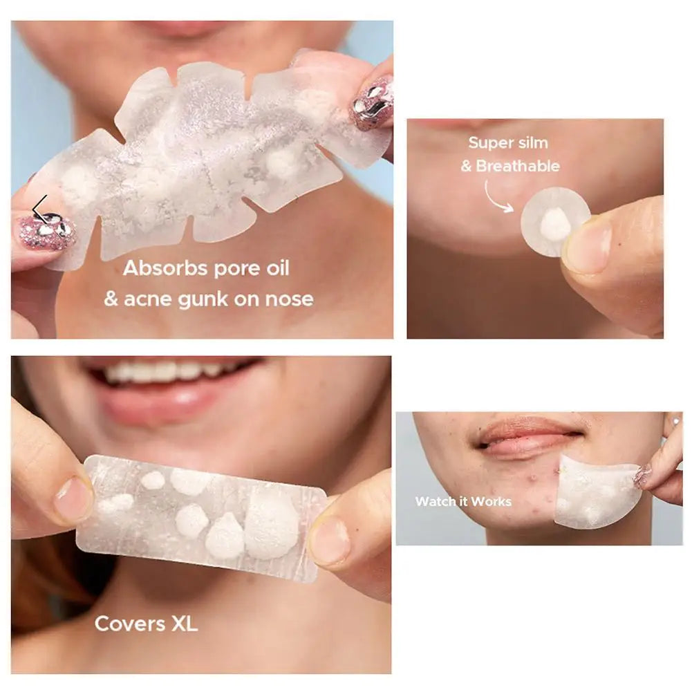 Large capacity Pimple Patches for Acne & Blemishes